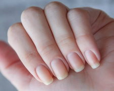 Як по нігтях визначити проблеми зі здоров’ям - поради дерматологині
