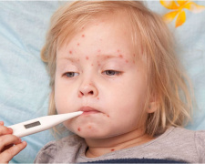 Епідемічна ситуація на Дніпропетровщині: зростання ГРВІ та спалах кору