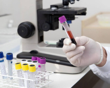 Епідемічна ситуація на Дніпропетровщині: отруєння грибами та зниження захворюваності на ГРВІ