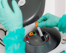 На Дніпропетровщині ГРВІ відступає, але епідпоріг у п'яти громадах досі перевищено: подробиці