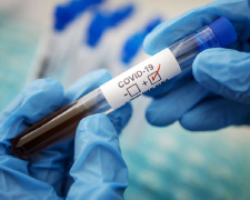 Епідситуація у Кам’янському: зафіксовано зростання кількості застуд та випадок COVID-19