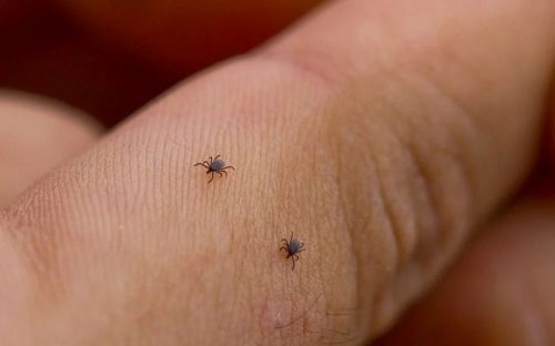 Сезон кліщів 2026 відкрито: де у Кам'янському найбільша небезпека та куди нести паразита після укусу