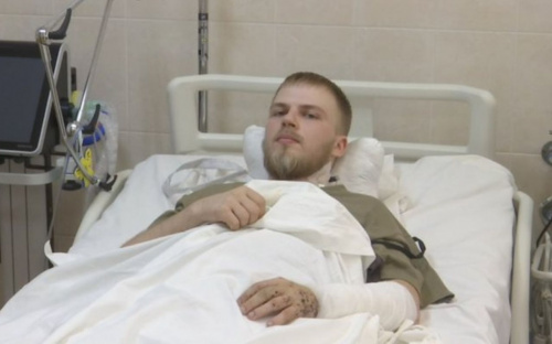 Втратив обидві ноги, а руки - посічені осколками: боєць із Кам'янського лікується на Дніпропетровщині