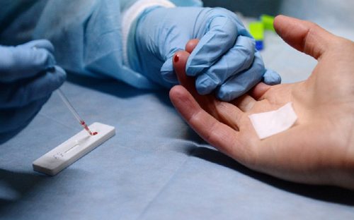 Де у Кам’янському можна зробити аналізи на ВІЛ та вірусні гепатити: перелік лікарень