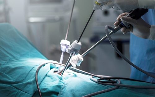 Безболісна хірургія в Кам’янському: роль лапароскопічної стійки