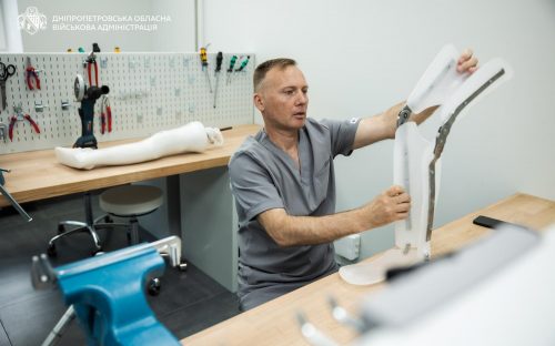 Новий шанс на повноцінне життя: на Дніпропетровщині запрацювала сучасна протезна майстерня
