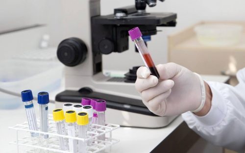 Епідемічна ситуація на Дніпропетровщині: захворюваність відповідає сезонному рівню