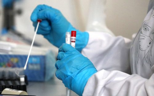ГРВІ, кишкові інфекції та перевірка води: епідситуація на Дніпропетровщині за тиждень