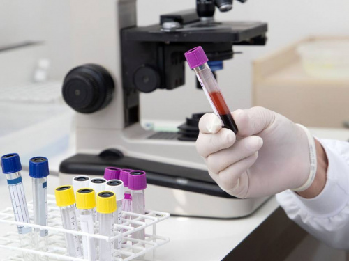 Епідемічна ситуація на Дніпропетровщині: захворюваність ГРВІ падає, проте зафіксовано летальний випадок