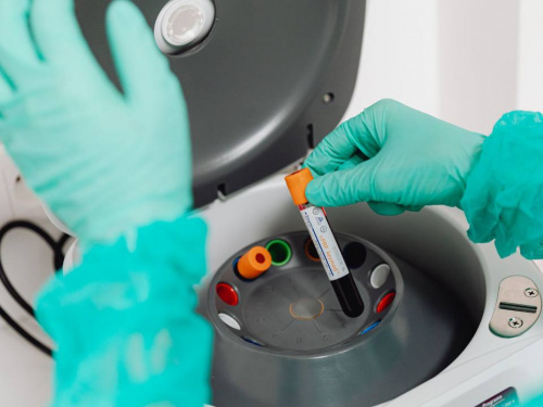 На Дніпропетровщині ГРВІ відступає, але епідпоріг у п'яти громадах досі перевищено: подробиці