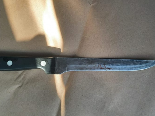 Жахлива сварка в Кам'янському районі: чоловік наніс дружині ножем серйозні поранення
