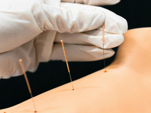 Кривава знахідка на Дніпропетровщині: люди скаржаться на їжу з голками