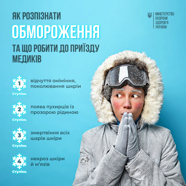 Як кам'янчанам розпізнати обмороження та що робити до приїзду медиків - поради від МОЗ