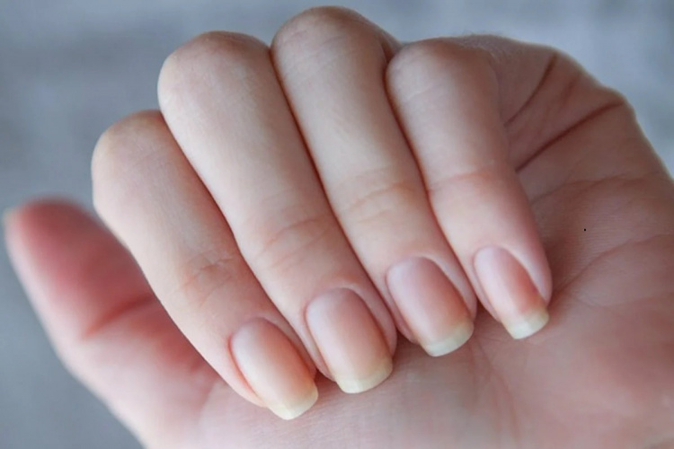 Як по нігтях визначити проблеми зі здоров’ям - поради дерматологині