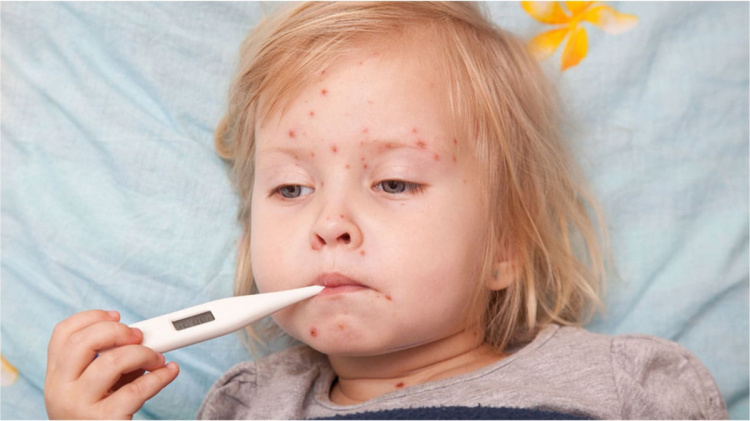 Епідемічна ситуація на Дніпропетровщині: зростання ГРВІ та спалах кору