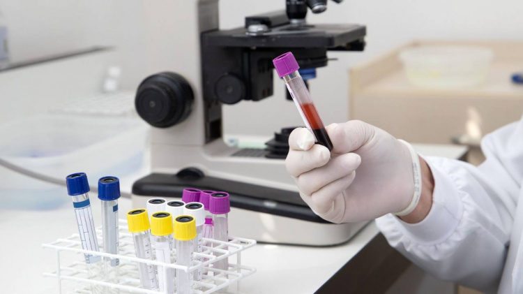 Епідемічна ситуація на Дніпропетровщині: отруєння грибами та зниження захворюваності на ГРВІ