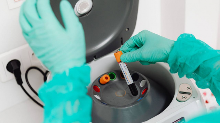 На Дніпропетровщині ГРВІ відступає, але епідпоріг у п'яти громадах досі перевищено: подробиці